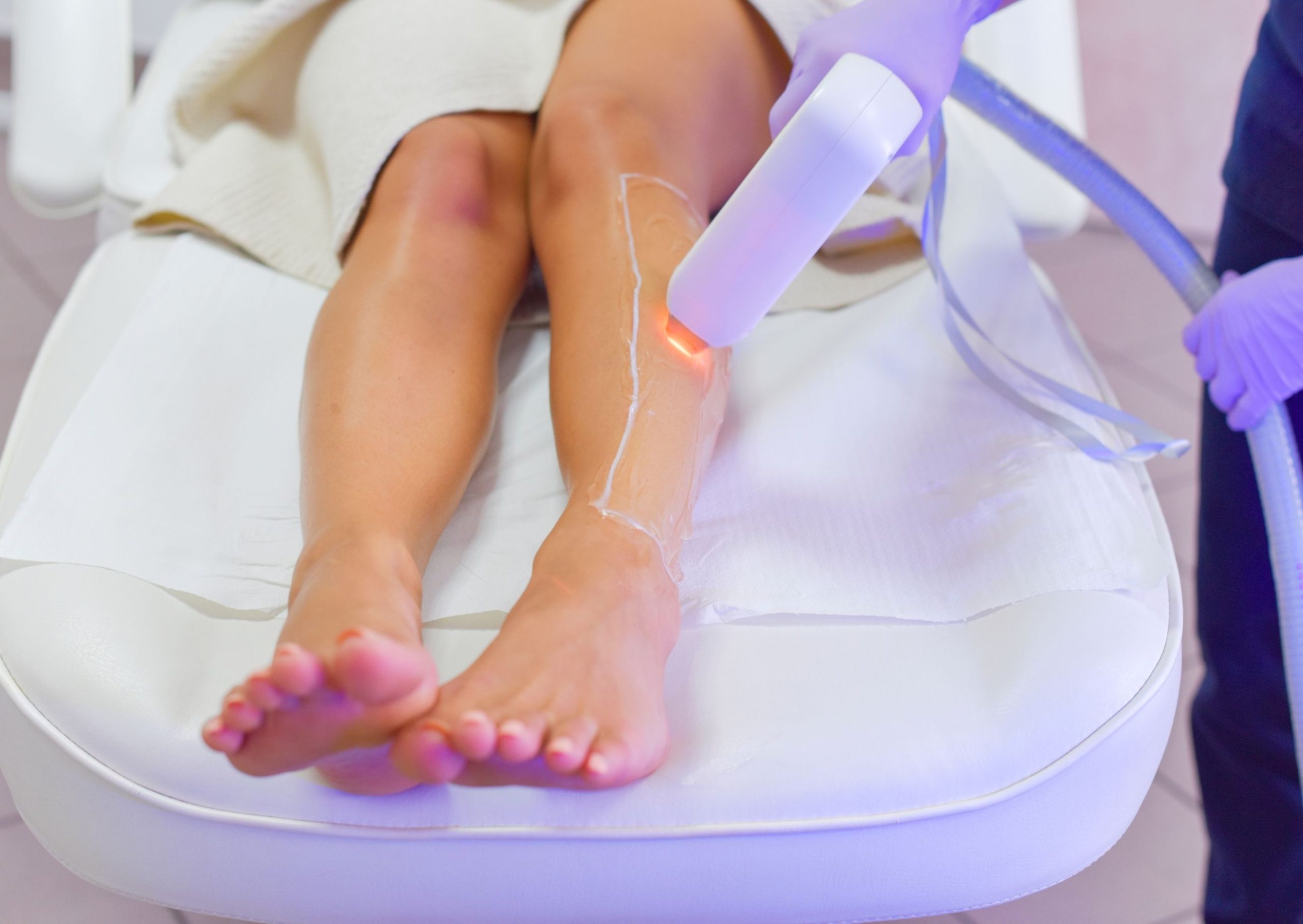 Depilazione laser permanente