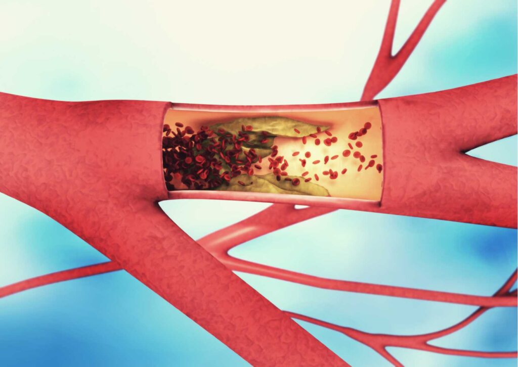 5 modi per rafforzare i vasi sanguigni 