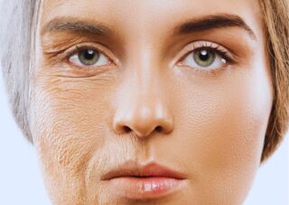 Deformazione del viso dovuta all'età - cause e rimedi naturali